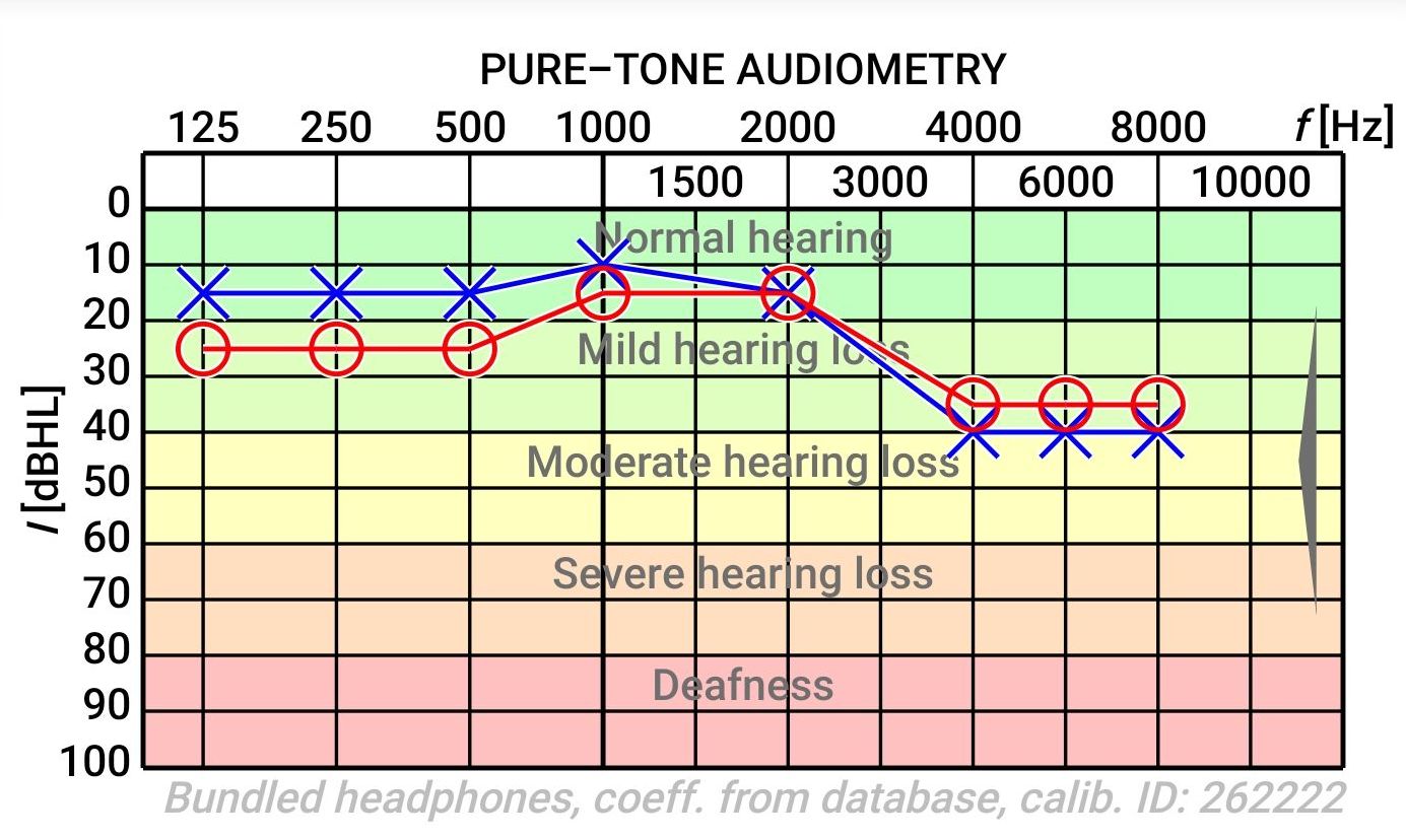 hearing-test-jpg.jpg